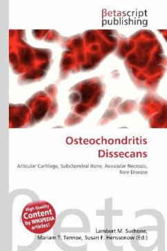 Osteochondritis Dissecans