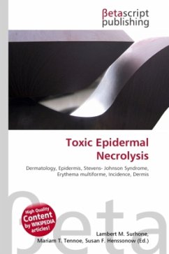 Toxic Epidermal Necrolysis