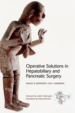 Operative Solutions in Hepatobiliary and Pancreatic Surgery - Maddern, Guy; Dennison, Ashley