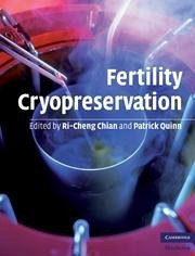 Fertility Cryopreservation