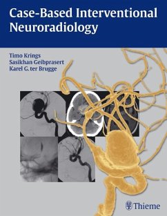 Case-Based Interventional Neuroradiology - Krings, Timo;Geibprasert, Sasikhan;Brugge, Karel ter