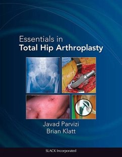 Essentials in Total Hip Arthroplasty - Parvizi, Javad; Klatt, Brian