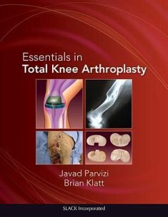 Essentials in Total Knee Arthroplasty - Parvizi, Javad; Klatt, Brian