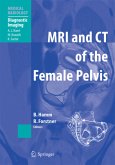 MRI and CT of the Female Pelvis MRI and CT of the Female Pelvis