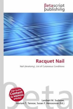 Cover Racquet Nail