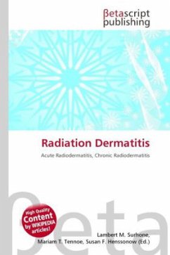 Radiation Dermatitis
