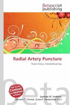 Radial Artery Puncture