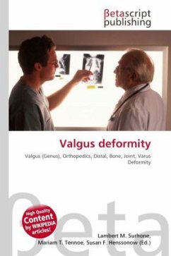 Valgus deformity