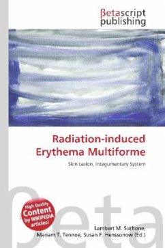 Radiation-induced Erythema Multiforme
