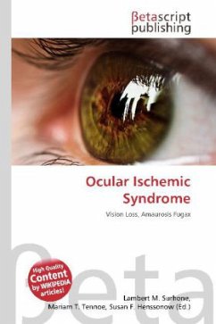 Ocular Ischemic Syndrome