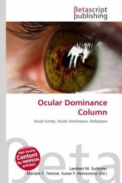 Ocular Dominance Column
