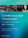 Cerebrovascular Ultrasound in Stroke Prevention and Treatment