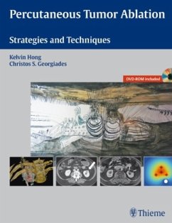 Cover Percutaneous Tumor Ablation, w. DVD-ROM