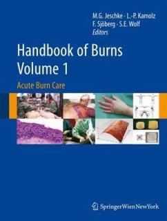 Cover Handbook of Burns