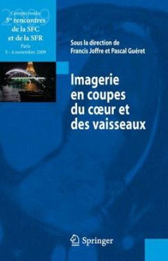 Imagerie en coupes du c ur et des vaisseaux