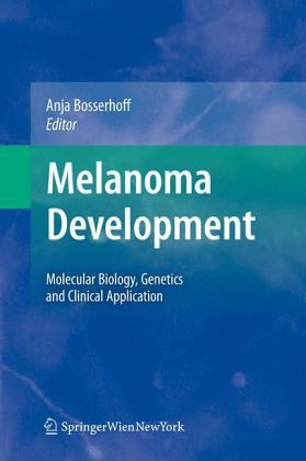 Melanoma Development Melanoma Development