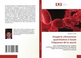 Imagerie ultrasonore quantitative à haute fréquence de la souris Imagerie ultrasonore quantitative à haute fréquence de la souris