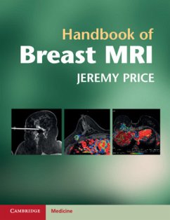 Handbook of Breast MRI - Price, Jeremy