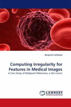Computing Irregularity for Features in Medical Images