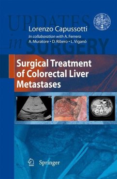 Surgical Treatment of Colorectal Liver Metastases