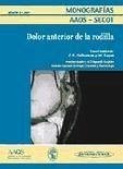 Dolor anterior de rodilla - Übersetzer: López, Gabriela Morando, Adriana