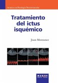 Tratamiento del ictus isquémico