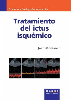 Cover Tratamiento del ictus isquémico