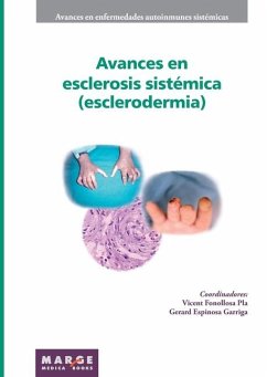 Avances en esclerosis sistémica (esclerodermia) - Espinosa Garriga, Gerard; Fonollosa Pla, Vicent; Cervera, Ricard