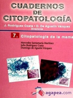 Citopatología de la mama - Agustín Vázquez, Domingo De; Rodríguez Costa, Julio; Santamaría Martínez, Mercedes