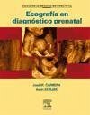 Ecografía en diagnóstico prenatal - Carrera Maciá, José María