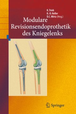 Revisionsendoprothetik des Kniegelenks