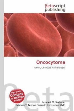 Oncocytoma