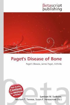 Paget's Disease of Bone