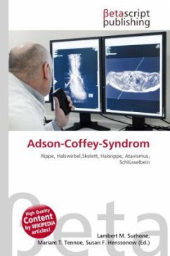 Adson-Coffey-Syndrom