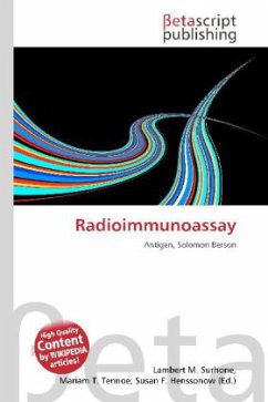 Radioimmunoassay