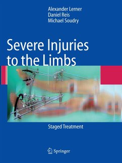 Severe Injuries to the Limbs - Lerner, Alexander;Reis, Daniel;Soudry, Michael