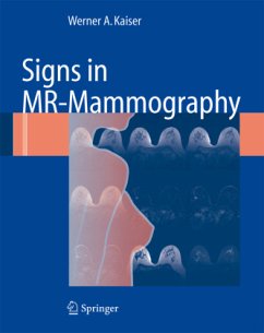 Signs in MR-Mammography - Kaiser, Werner A.