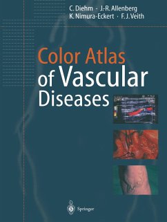 Color Atlas of Vascular Diseases - Diehm, C.;Allenberg, J.-R.;Nimura-Eckert, K.