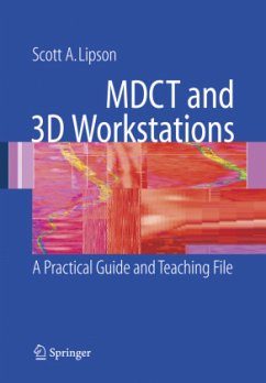 MDCT and 3D Workstations - Lipson, Scott A.