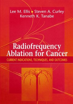 Radiofrequency Ablation for Cancer