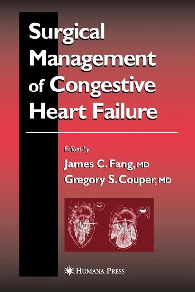 Surgical Management of Congestive Heart Failure Surgical Management of Congestive Heart Failure
