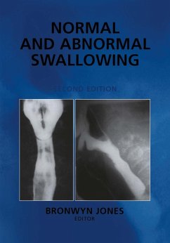 Cover Normal and Abnormal Swallowing