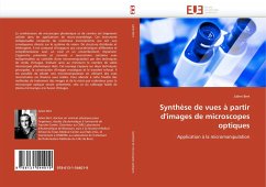 Synthèse de vues à partir d''images de microscopes optiques - Bert, Julien