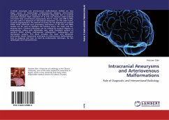 Intracranial Aneurysms and Arteriovenous Malformations - Sakr, Hossam