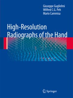 High-Resolution Radiographs of the Hand - Guglielmi, Giuseppe;Peh, Wilfred C. G.;Cammisa, Mario