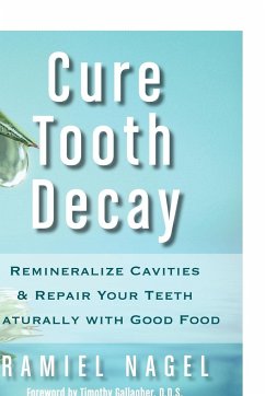 Cure Tooth Decay - Nagel, Ramiel