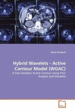 Hybrid Wavelets - Active Contour Model (WGAC)