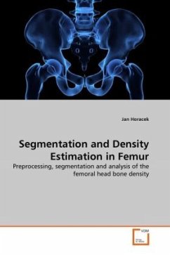 Segmentation and Density Estimation in Femur