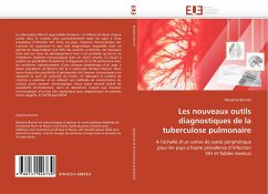 Les nouveaux outils diagnostiques de la tuberculose pulmonaire - Bonnet, Maryline