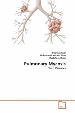 Pulmonary Mycosis - Anwar, Shafiq;Mohsin Khan, Mohammad;Siddiqui, Mustafa